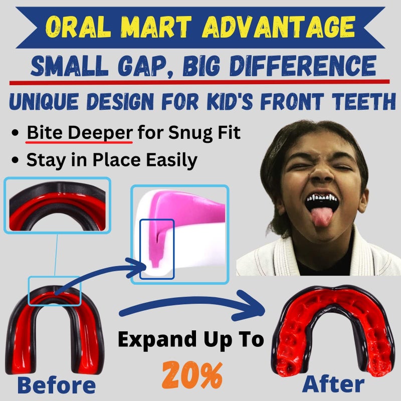 Oral Mart حارس الفم للأطفال من أورال مارت باللونين الأبيض والأزرق الداكن للرياضات - حارس فم للشباب للكاراتيه، كرة القدم، فنون القتال، التايكوندو، الملاكمة، الرجبي، BJJ، موياي تاي، كرة القدم، الهوكي (مع علبة مجانية) - Image 5